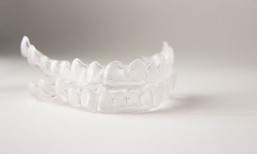 Invisible Braces