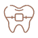 Lingual braces