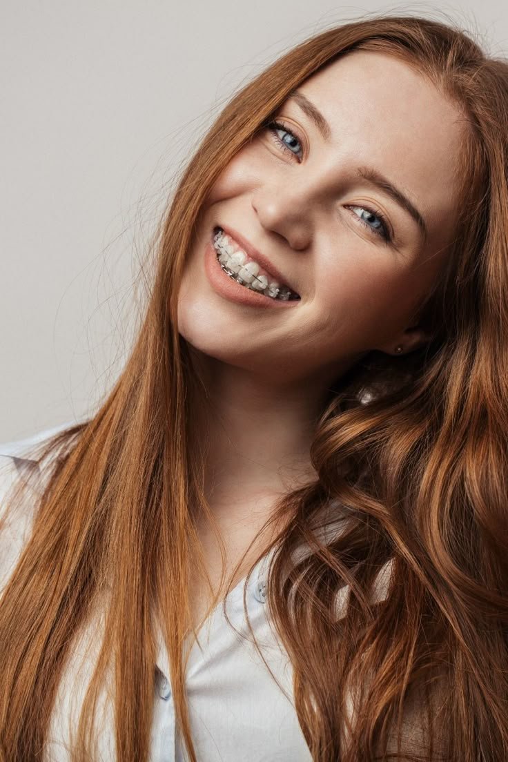 Ceramic Braces image 3