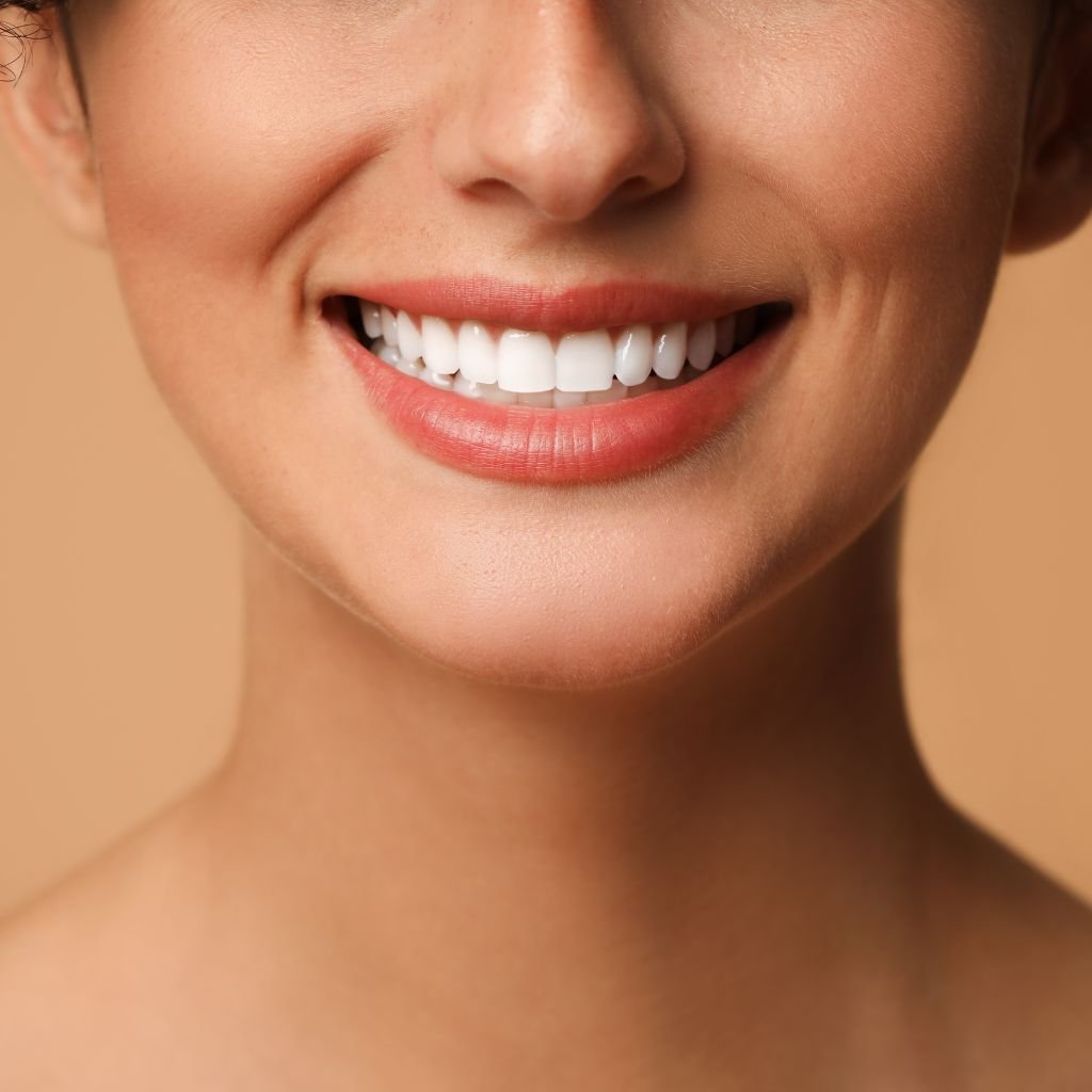 Veneers Dubai image