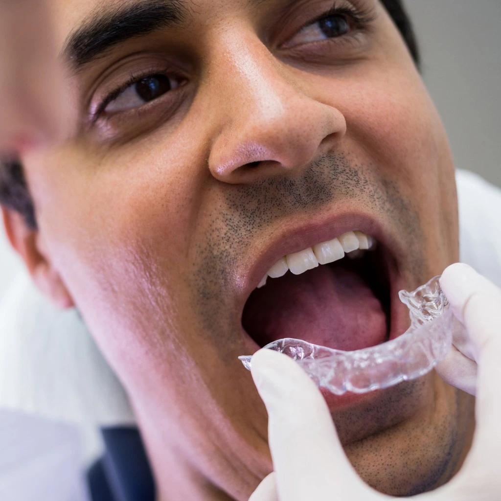 Ceramic braces image