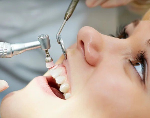 Close-up of a patient receiving professional dental polishing and scaling at Invisible Braces Dental & Skin Clinic.