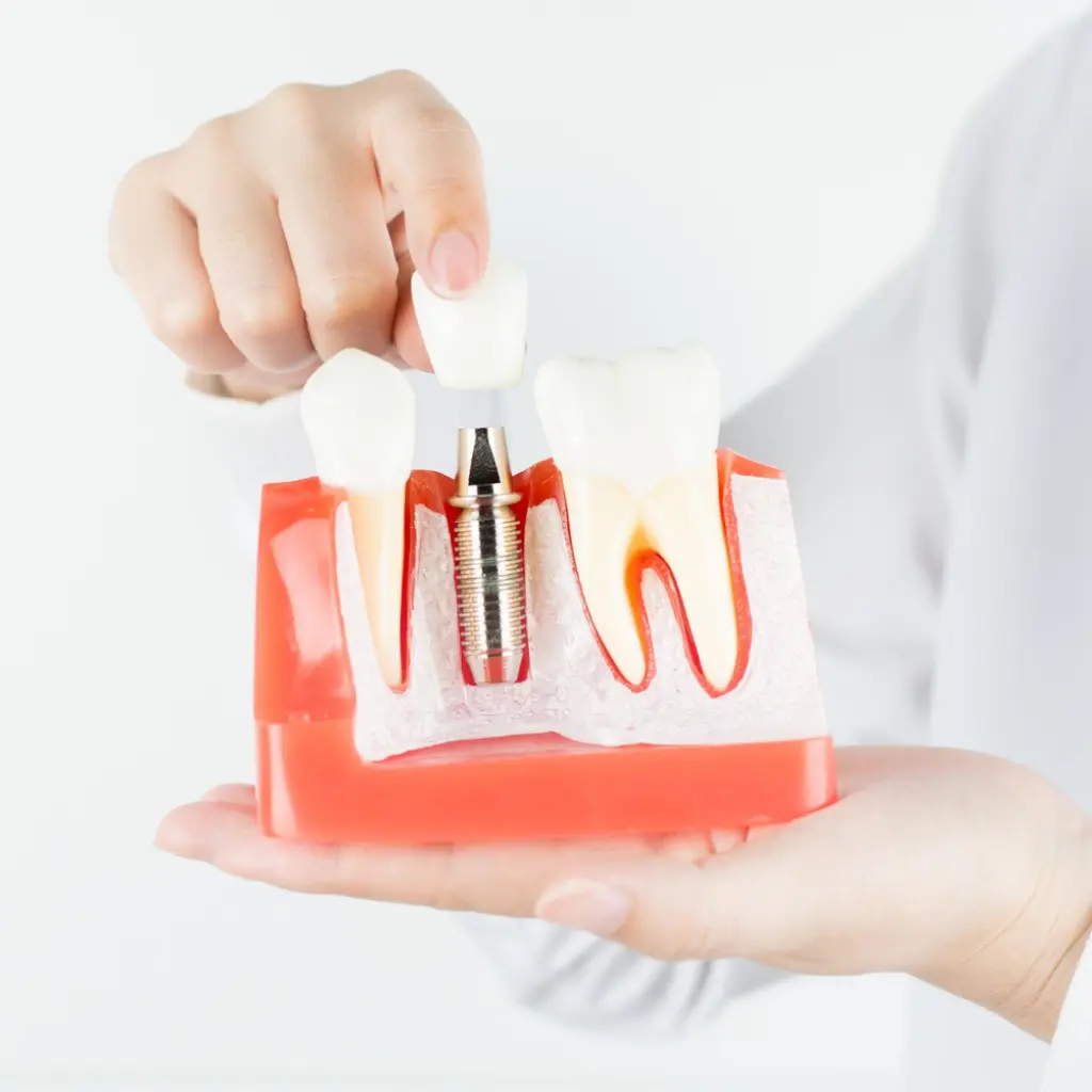 Dental implant with crown restoration demonstrating prosthodontic treatment for missing teeth at Invisible Braces Dental Clinic