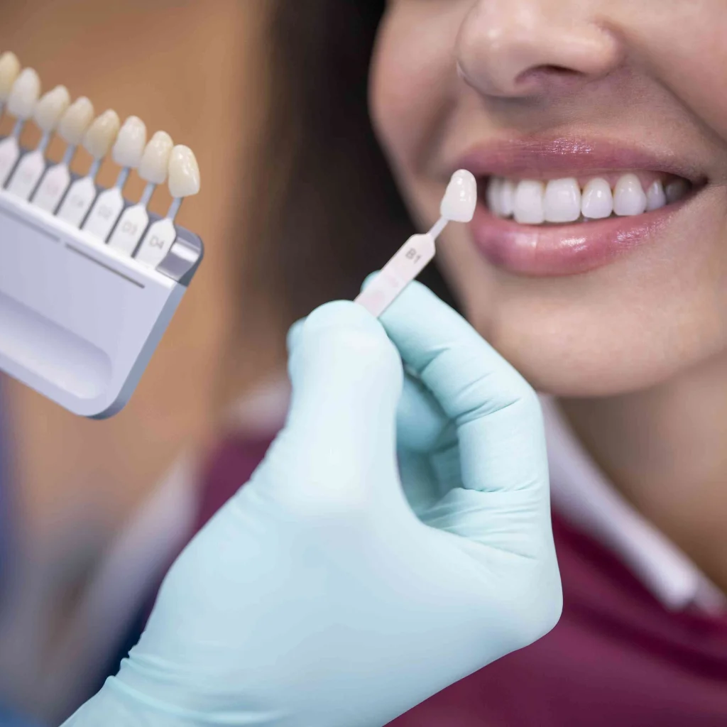 Dentist matching tooth shade for dental veneers during smile makeover consultation in Dubai